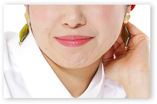 フラーレン配合